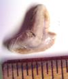 Pathologic Tiger Shark Tooth