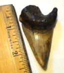 Extreme Pathologic Angustidens Tooth