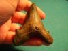 unknown tooth 